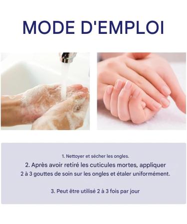  Qkbuza Strengthening and Fortifying Nail Treatment 10ml Smoothing and Strengthening Nail Care Solution Prevents Discoloration and Cracking of Dry and Damaged Nails - Buy Online on GoSupps.com