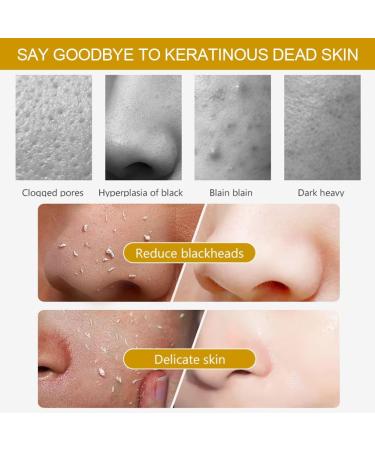 Lemon Exfoliating Gel Lemon Peeling Gel Exfoliating Whitening Gel Lemon Face Exfoliator Gel Vitamin C Face Scrub Lemon Exfoliating Face Scrub Lemon Whitening Exfoliator For Radiant Skin 100ml - Buy Online on GoSupps.com