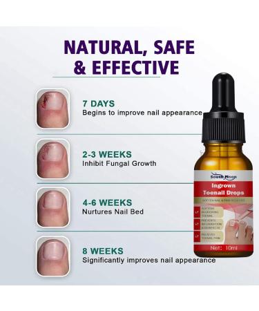 Nail Helper Ingrown Toenail Corrector - Drops for Toenail Correction & Growth Treatment | Fungal Nail & Cuticle Oil Care - Buy Online on GoSupps.com