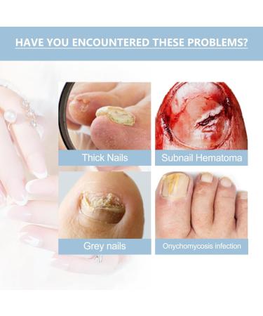 Onyxoguard Nail Growth & Repair Serum - Strengthener for Thin Brittle Nails | Crystal Clear Base Coat Treatment - Buy Online on GoSupps.com
