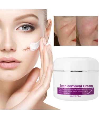 Scar Removal Cream with Plant Extract Stretch Marks & Scars Repair Gel 50ml for Fading Scar and Remove Stretch Marks - Buy Online on GoSupps.com
