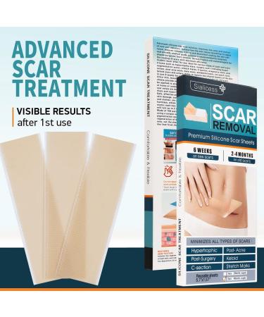 Sialicess Reusable Silicone Scar Strips for Keloid & Hypertrophic Scars - 2 Month Supply - 4 PCS - Buy Online on GoSupps.com