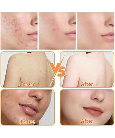  HADAVAKA Turmeric Soap For Skin Lightening Smooth And Gentle Turmeric Bath Soap For Men And Women 100g Ginger Soap Moisturizing And Deep Cleansing (2PCS) - Buy Online on GoSupps.com