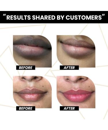 Lip Lightener Smoker Balm for Dry Chapped Dark & Smoky Lips| Moisturizes Nourishes & Soften Lips | Enriched with Jojoba oil Beetroot & Olive oil | For Men & Women - 4 ml - Buy Online on GoSupps.com