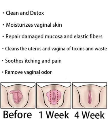 Annie Care Natural Detox Viginal Gel & Slimming Capsules Bundle - Anti-Itch, Firming, Repair, Pink and Tender - 5 Bag Set - Buy Online on GoSupps.com