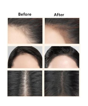 2PCS Hairline Powder Stick - Instant Root Concealer for Hair | Color Quick Cover with Shadow Touch Up & Hair Filler Sponge Pen - Buy Online on GoSupps.com