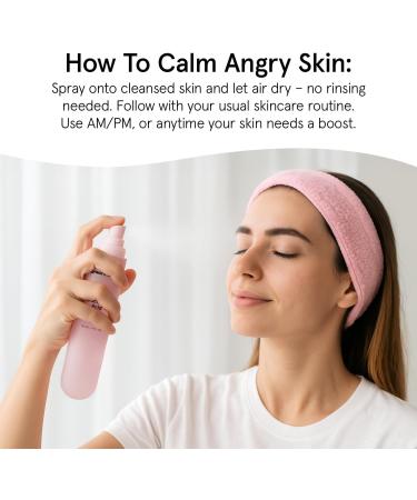 grace & stella Hypochlorous Acid Spray for Face - Body Acne Spray - Gentle Face Mist to Calm Redness & Flare-Ups Back Acne - Soothing Facial Mist for Sensitive Skin - Travel Size (60 ml/2 fl oz) - Buy Online on GoSupps.com