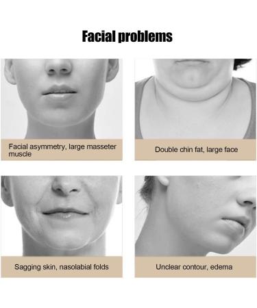 Sonew Electric V-Face Shaping Massager | High-Frequency Facial Lifting Device | Doppelkinn Reducer & Remote Control | International Shipping Available - Buy Online on GoSupps.com