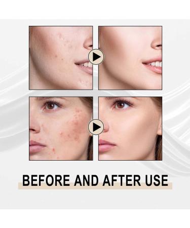  Pruojhw Pore Refining with Lactobionic Acid Nourishing Refining Lactobionic Acid 30ml Intensive Face Treatment. Hydrates & Softens Skin Fines Pores Instant Perfection for Women Girls and Ladies - Buy Online on GoSupps.com