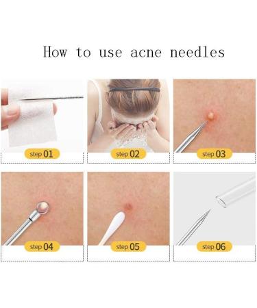 5 Pieces of Stainless Steel Blackhead Wrinkle Removal Clip Blackhead Acne Extractor Stainless Steel Beauty Tool for Female Girls B - Buy Online on GoSupps.com