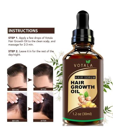 VOTALA Hair Growth Serum | Anti Hair Loss Treatment for Men & Women | Promotes Thicker & Stronger Hair with Regrowth Benefits - Buy Online on GoSupps.com
