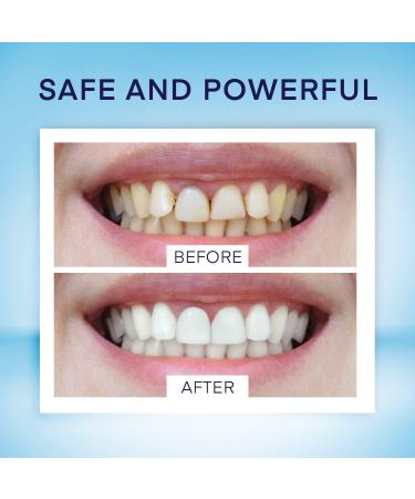 NC LIVING Teeth Whitening Pen 4-Pack 60+ Uses Brighten Your Smile in Just 1 Week with Tooth Whitening Kit - Fast Gentle Enamel Safe Whitening Gel for White Teeth - Buy Online on GoSupps.com