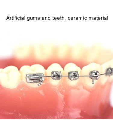 Dytah 1:1 Orthodontic Treatment Teeth Model - Patient Communication & Teaching Tool with Metal & Ceramic Brackets for Adults - Buy Online on GoSupps.com
