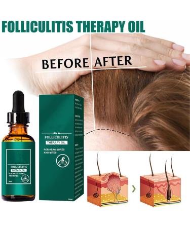 Allayu Adults Dense Hair Growth Essential Oil Natural Ingredient Regrowth Follicle Repair Essence Serum Beauty Supplies - Buy Online on GoSupps.com