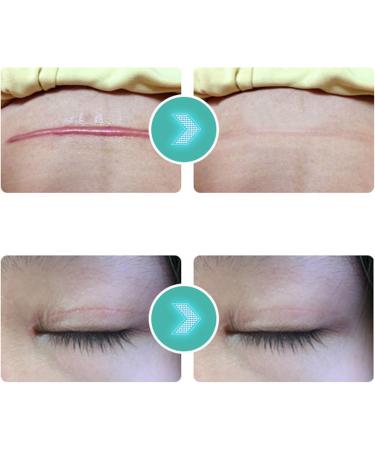 Professional Scar Wrap Tape | UV Protection | Self-Adhesive for Home Use - Buy Online on GoSupps.com