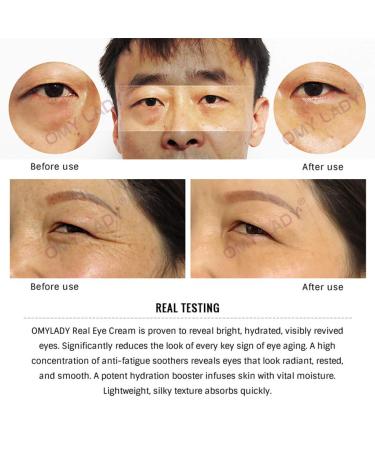 YJYdada OMY LADY Anti-Wrinkle Eye Cream Serum - Moisturizing Anti-Aging Eye Care Essence (Multicolor) - Buy Online on GoSupps.com