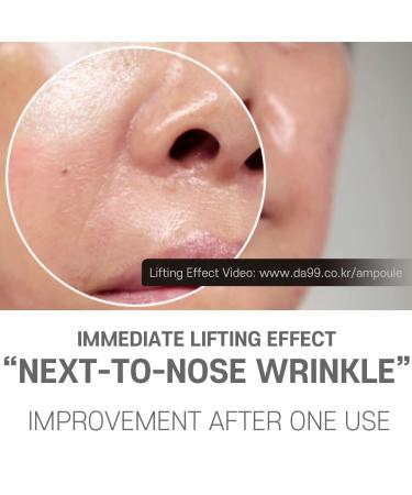 Home Esthetic Lifting Ampoule - Anti-Wrinkle & Anti-Aging K-Beauty Skin Care (4 Ampoules 5.61 oz) - International Shipping - Buy Online on GoSupps.com