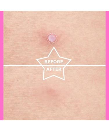 AUSLKA Hydrocolloid Patches (112 Count) - Hydrocolloid Spot Cover - Zit Stickers for Face and Skin Vegan-friendly and Not Tested on Animals 1 count (Pack of 112) - Buy Online on GoSupps.com