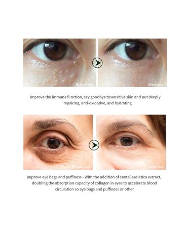 DISAAR Beauty Collagen Snail Extract Eye Cream Anti-Wrinkle Dark Circles Eye Bags & Anti-Aging Treatment Hydrating & Firming Under Eye Care 20ml / 0.7 fl.oz - Buy Online on GoSupps.com