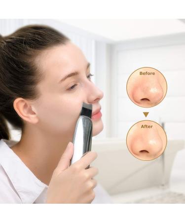 TOUCHBeauty Rechargeable Facial Scrubber Spatula & Blackheads Remover - Red Dot Winner 2021 - Buy Online on GoSupps.com