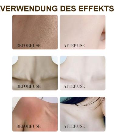 MEITREND Coconut Body Butter 200 g natural coconut oil body cream for dry skin coconut oil skin care body moisturizer coconut body moisturizer coconut lotion - Buy Online on GoSupps.com