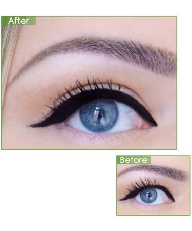 5MM Natural Invisible Eyelid Tape Stickers - 288pcs, Medical-use Fiber, Instant Eye Lift Without Surgery - Perfect for Uneven Mono-Eyelid - Buy Online on GoSupps.com