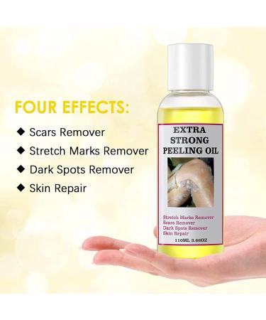 Extra Strong Peeling Oil Body Peeling Oil Extra Strong Safe Yellow Peeling Powerful Body Scrub Against Stretch Marks and Dark Sports 110 ml - Buy Online on GoSupps.com
