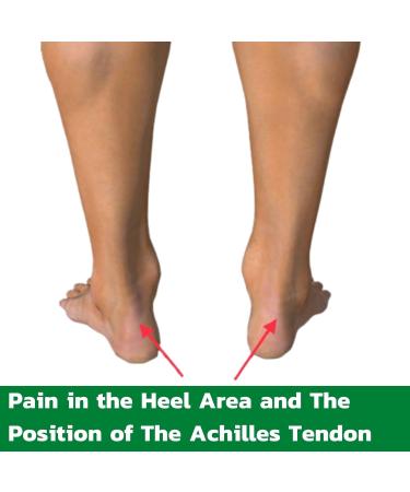 Achilles Tendon Heel Socks Sleeve | Compression Ankle Brace for Pain Relief | Plantar Fasciitis & Joint Support | Men & Women - Buy Online on GoSupps.com