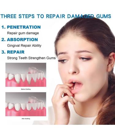 EIRZNGXQ Gum Treatment Drops 30ml - Repair & Nourish Gums | International Shipping Available - Buy Online on GoSupps.com