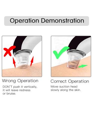 QQcute Blackhead Remover Electric Vacuum Suction Pore Cleaner - Deep Facial Skin Cleaning Beauty Device - Buy Online on GoSupps.com