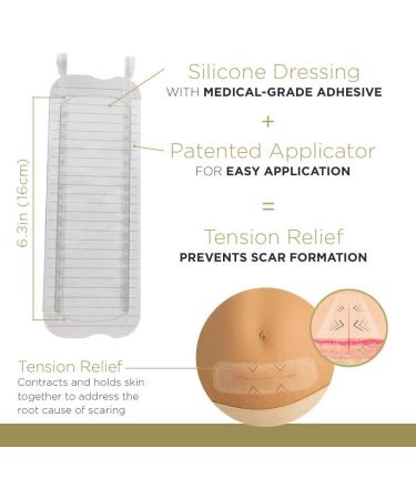 X-Large Silicone Scar Sheets - 6.3 Inch, FDA-Cleared, 30 Day Supply | Active Scar Defense for New Scars - Buy Online on GoSupps.com