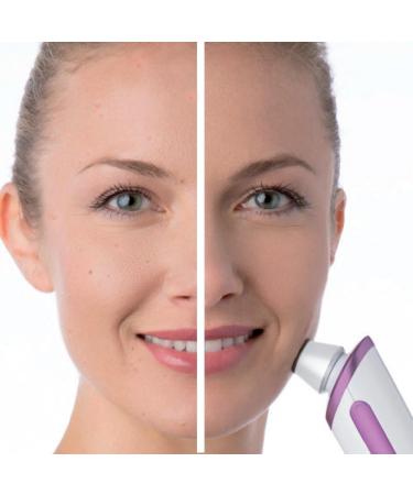 Beurer FC 76 Microdermabrasion Device - Improve Complexion & Refine Pores | Lightweight Handheld Skin Care Tool - Buy Online on GoSupps.com