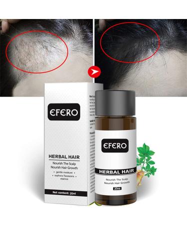 Hair Growth Serum - Fast Regrowth & Anti Hair Loss Oil for Dense Beautiful Hair | International Shipping - Buy Online on GoSupps.com