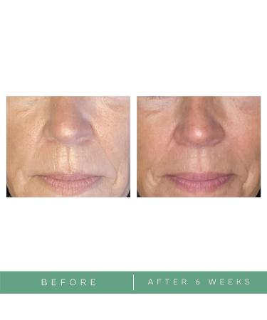 Replenix Age Restore Nighttime Therapy - Anti-Aging Night Cream with Green Tea | 1.7 oz - Buy Online on GoSupps.com