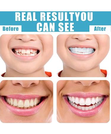 2 Pairs Provisional Tooth Rails & Dentures | Immediate Veneers for Men & Women | Whitening Alternative for Bad Teeth - Buy Online on GoSupps.com