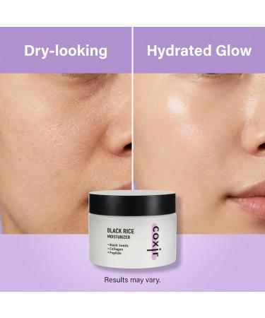 coxir Black Rice Moisturizer Face Cream Hydrating Korean Moisturizer with Niacinamide Collagen & Peptide Complex Radiance Barrier Support Lightweight Non-Greasy(1.69 fl oz) - Buy Online on GoSupps.com