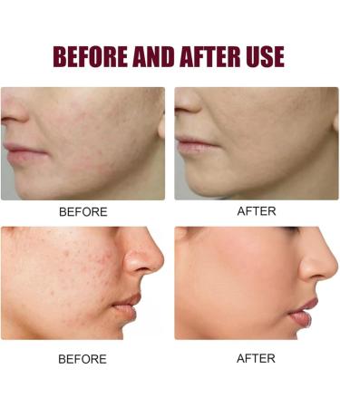 7% Glycolic Acid Toner Glycolic Acid Toner Suitable for All Skin Type Gylcolic Acid Glycolic Acid 7% Toner Skincare Hydrating Toner Brighten Rejuvenate Moisturize & Strengthen Your Skin - Buy Online on GoSupps.com