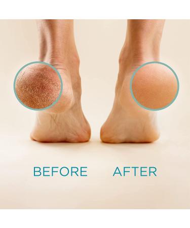 Crystal Foot File - Callus Remover for Feet | Dead Skin Scrubber for Hands & Heels - Pedicure Tool for Men & Women - Buy Online on GoSupps.com