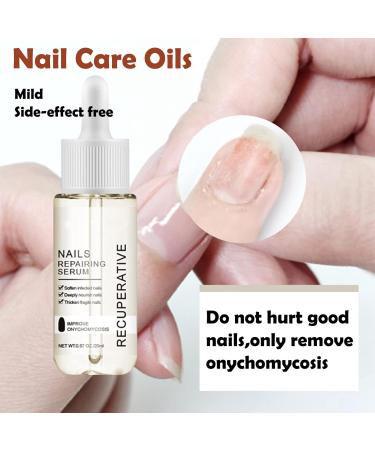 Nail Growth and Strengthening Serum 20ml Nails Repair Serum Fungal Nail Treatment for Toenail Extra Strong Toenail Growth Treatment for Repairing Damaged and Discolored Nails Improve Onychomycosis - Buy Online on GoSupps.com