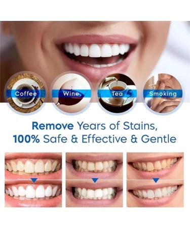 2023 Newest Teeth Whitening Essence - 10 Seconds Intensive Stain Removal & Beautiful White Smile | Teeth Whitening Foam & Pen (1Pcs) - Buy Online on GoSupps.com