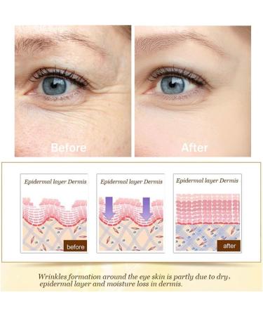 Gel Eye Masks Under Eye Patches for Puffiness and Dark Circle(20 Pairs) - Buy Online on GoSupps.com