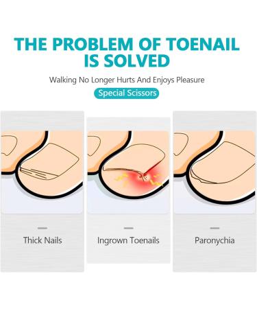 Professional Toenail Clippers Set for Thick Nails - Heavy Duty Large Nail Scissors for Men & Women - Long Handle Safety Design - Ideal for Elderly and Ingrown Nails - RONAVO Thick Nails Kit - Buy Online on GoSupps.com