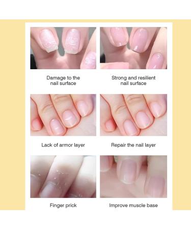 Huile durcissante pour ongles | Huile pour cuticules pour une croissance et un renforcement rapides des ongles P n tration rapide et facile d'entretien avec effet de renforcement naturel pour les - Buy Online on GoSupps.com