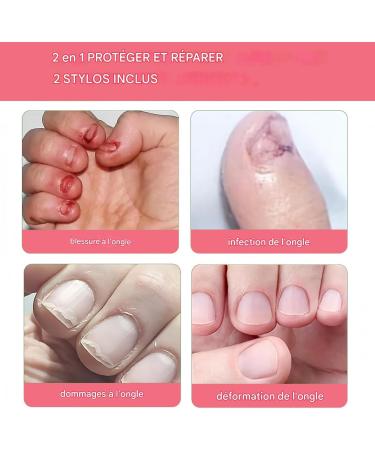  Xijobido Nail Polish to Prevent Nail Biting - 12ml Natural Flavor with Secure Coating - Prevents the Habit of Biting Thumb Growth and Sucking - Buy Online on GoSupps.com