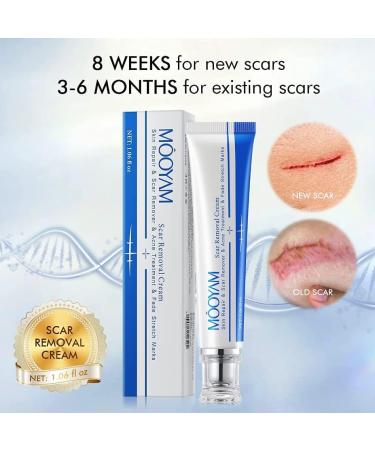 Harsha Tamoskiny Scar Removal Cream 30g - for Stretch Marks, Surgery, Injuries & Burns - All Skin Types - Buy Online on GoSupps.com
