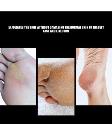 Professional Nail Polishing Head Stainless Steel Foot Nail Drill Bit Pedicure Foot Calluses Sanding Polishing Head for Electric Nail File - Buy Online on GoSupps.com