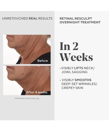 Murad Retinal ReSculptors 2-Piece Full Size Kit ($197 Value) - Retinal Serum & Eye Cream - 2.5x Vitamin A Lifts Firms Anti-Aging Encapsulated Retinal Reduces Wrinkles on Face Eyes & Neck - Buy Online on GoSupps.com