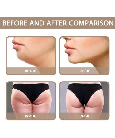  Rosixehird Ginger Firming Cream 50g for the stomach - Fast-absorbing firming and toning cream - Hot cream against cellulite to soothe relax tone and - Buy Online on GoSupps.com