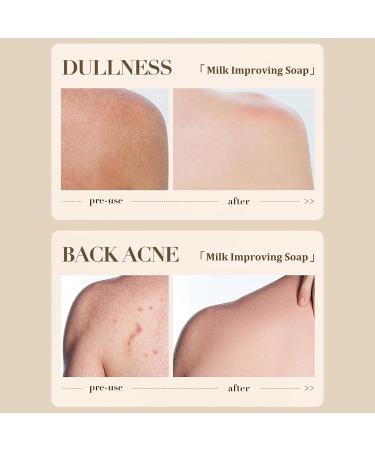 Natural Milk Soap - Ceramide Soap Bar - Dark Spot Remover for Face Soap Bar - Moisture Hydrate Skin Smooth Tender Plump - Clean Pore Dirt Reduce Dryness - Firm Lift Restore Elasticity Complexion Tone - Buy Online on GoSupps.com