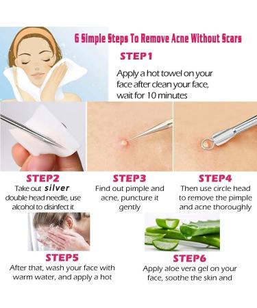 Musment 5PCS Blackhead Remover Pimple Tool Kit Acne Tools - Buy Online on GoSupps.com